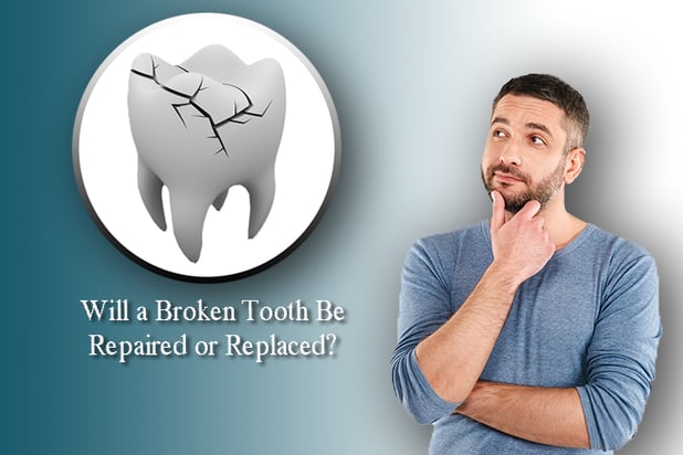 Is it best to Fix or Replace a Damaged Tooth?