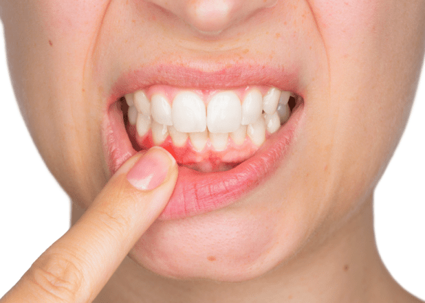 Top Reasons To Invest In The Health Of Your Gums